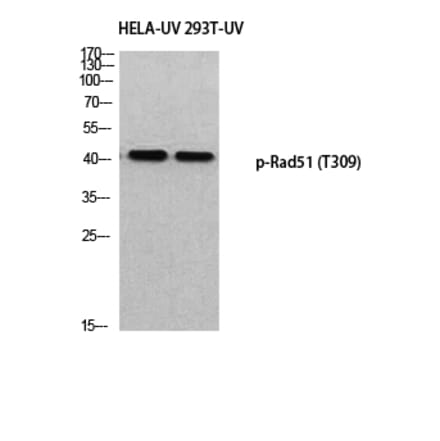 Western Blot - Anti-RAD51 (phospho Thr309) Antibody (A8410) - Antibodies.com