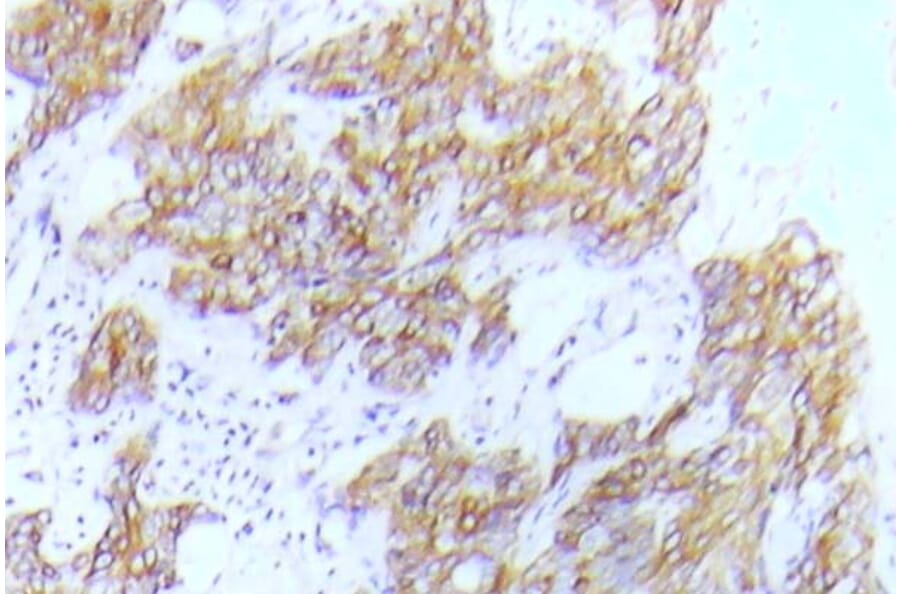 Immunohistochemistry - Anti-Flt-3 (phospho Tyr591) Antibody (P12-1022) - Antibodies.com