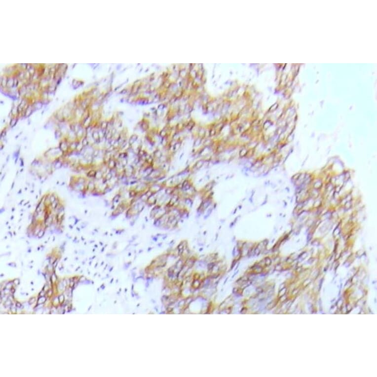 Immunohistochemistry - Anti-Flt-3 (phospho Tyr591) Antibody (P12-1022) - Antibodies.com