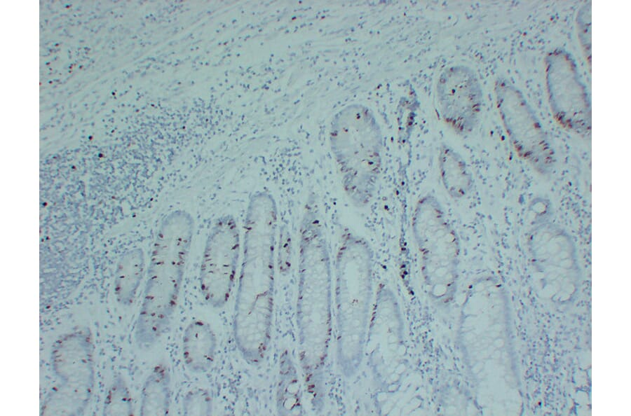 Immunohistochemistry - Anti-Topoisomerase II alpha Antibody (V0132) - Antibodies.com