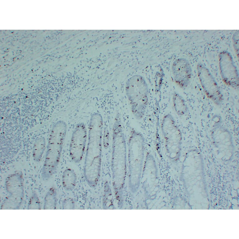 Immunohistochemistry - Anti-Topoisomerase II alpha Antibody (V0132) - Antibodies.com