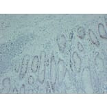 Immunohistochemistry - Anti-Topoisomerase II alpha Antibody (V0132) - Antibodies.com