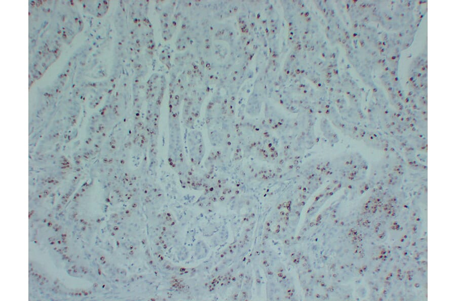 Immunohistochemistry - Anti-Topoisomerase II alpha Antibody (V0132) - Antibodies.com