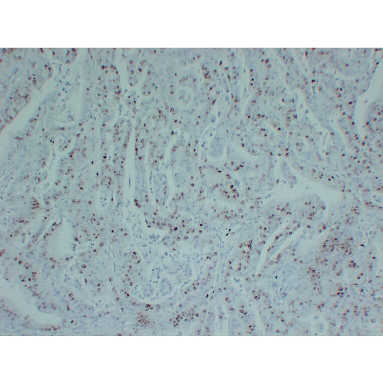 Immunohistochemistry - Anti-Topoisomerase II alpha Antibody (V0132) - Antibodies.com