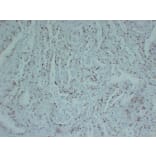 Immunohistochemistry - Anti-Topoisomerase II alpha Antibody (V0132) - Antibodies.com