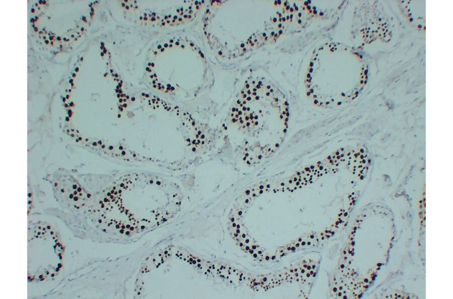 Immunohistochemistry - Anti-Topoisomerase II alpha Antibody (V0132) - Antibodies.com