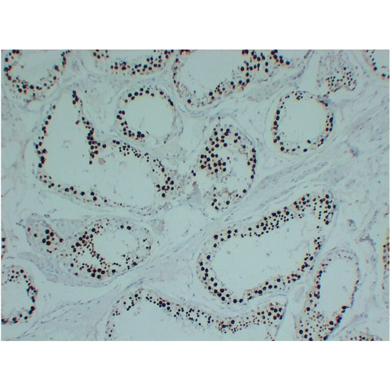 Immunohistochemistry - Anti-Topoisomerase II alpha Antibody (V0132) - Antibodies.com