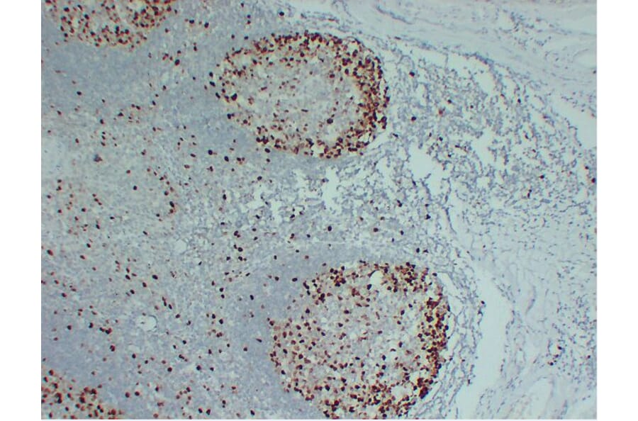 Immunohistochemistry - Anti-Topoisomerase II alpha Antibody (V0132) - Antibodies.com