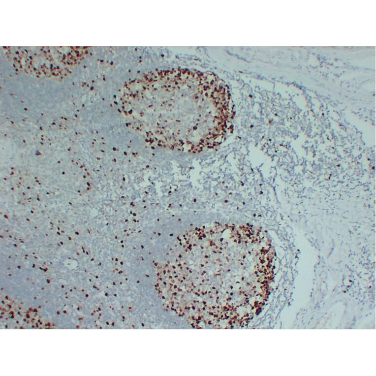 Immunohistochemistry - Anti-Topoisomerase II alpha Antibody (V0132) - Antibodies.com