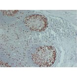 Immunohistochemistry - Anti-Topoisomerase II alpha Antibody (V0132) - Antibodies.com