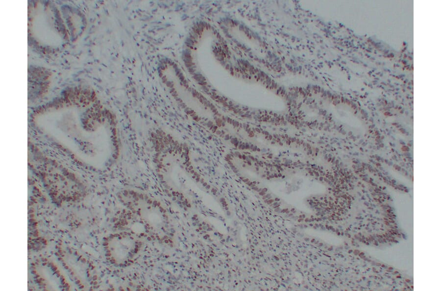Immunohistochemistry - Anti-MutS Protein Homolog 6 Antibody (V0095) - Antibodies.com