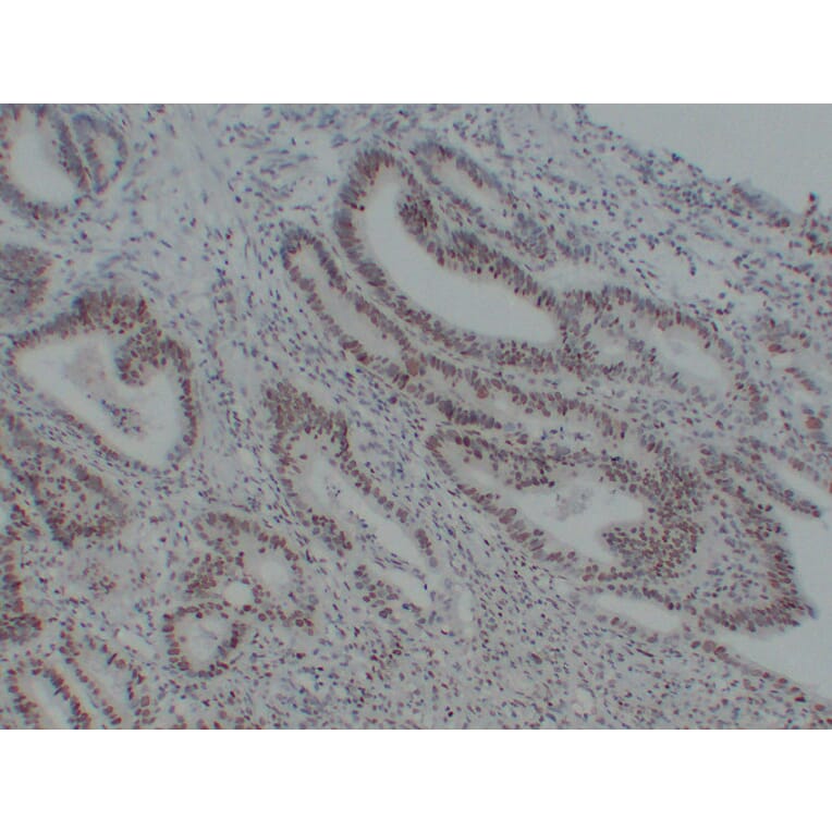 Immunohistochemistry - Anti-MutS Protein Homolog 6 Antibody (V0095) - Antibodies.com