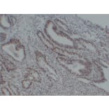 Immunohistochemistry - Anti-MutS Protein Homolog 6 Antibody (V0095) - Antibodies.com