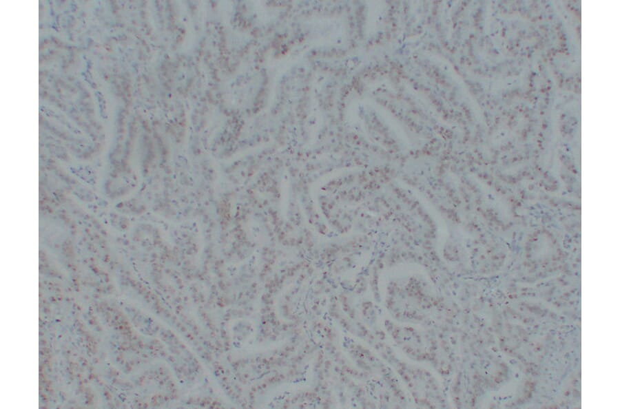 Immunohistochemistry - Anti-MutS Protein Homolog 6 Antibody (V0095) - Antibodies.com