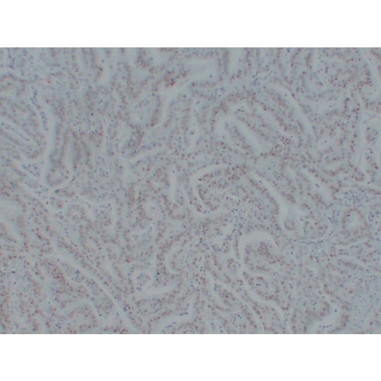 Immunohistochemistry - Anti-MutS Protein Homolog 6 Antibody (V0095) - Antibodies.com