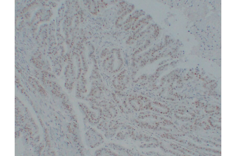 Immunohistochemistry - Anti-MutS Protein Homolog 6 Antibody (V0095) - Antibodies.com