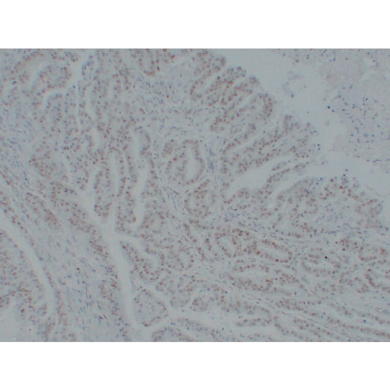 Immunohistochemistry - Anti-MutS Protein Homolog 6 Antibody (V0095) - Antibodies.com