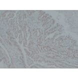 Immunohistochemistry - Anti-MutS Protein Homolog 6 Antibody (V0095) - Antibodies.com