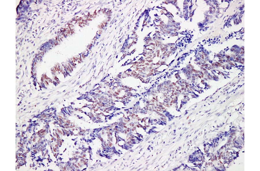 Immunohistochemistry - Anti-MutS Protein Homolog 6 Antibody (V0095) - Antibodies.com