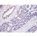 Immunohistochemistry - Anti-MutS Protein Homolog 6 Antibody (V0095) - Antibodies.com