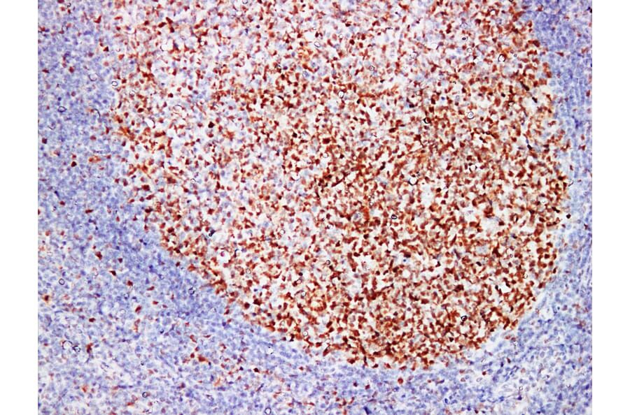 Immunohistochemistry - Anti-MutS Protein Homolog 6 Antibody (V0095) - Antibodies.com