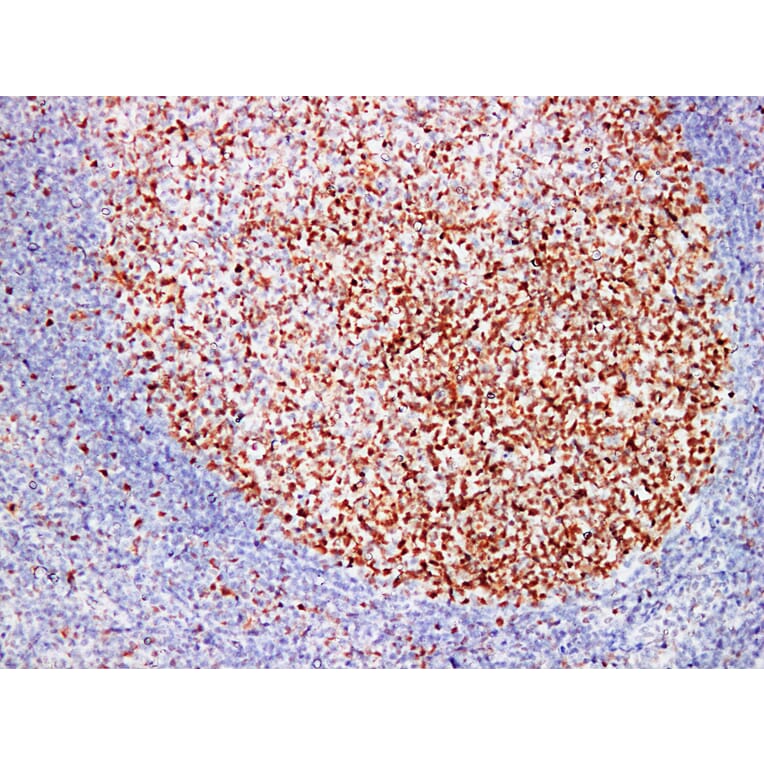 Immunohistochemistry - Anti-MutS Protein Homolog 6 Antibody (V0095) - Antibodies.com