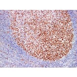 Immunohistochemistry - Anti-MutS Protein Homolog 6 Antibody (V0095) - Antibodies.com