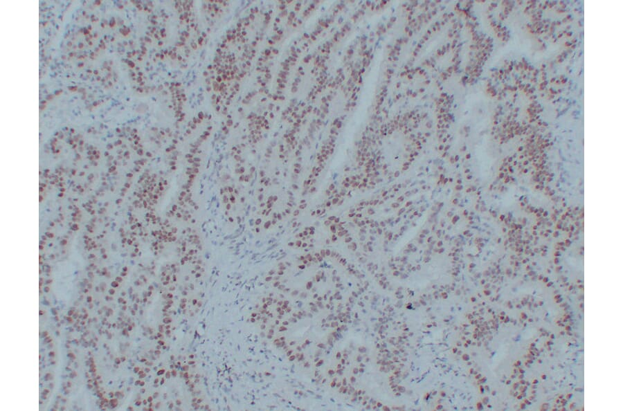 Immunohistochemistry - Anti-MutL Protein Homolog 1 Antibody (V0094) - Antibodies.com