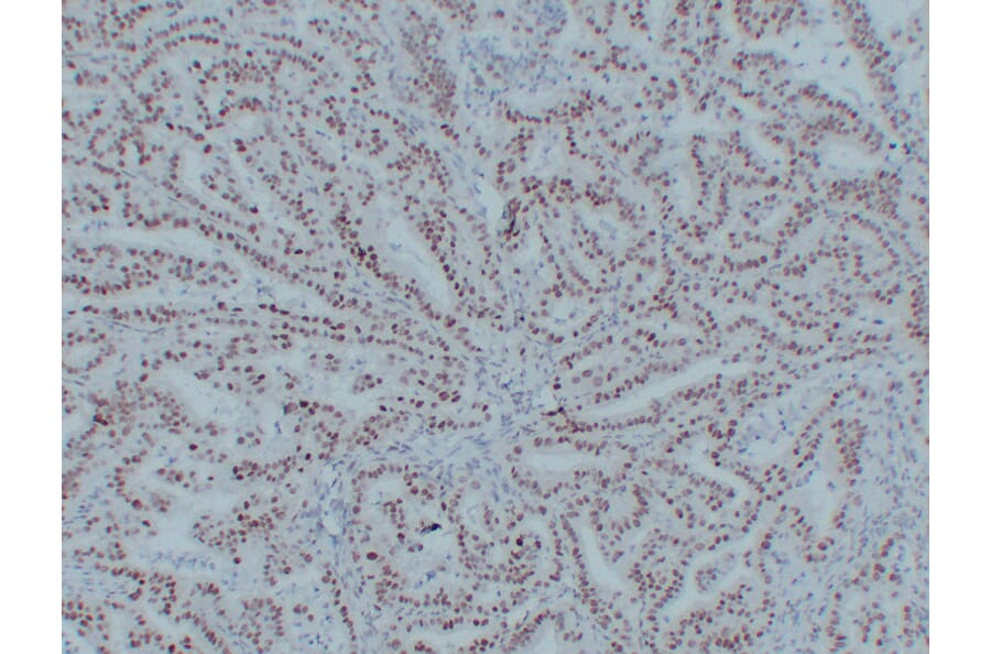 Immunohistochemistry - Anti-MutL Protein Homolog 1 Antibody (V0094) - Antibodies.com