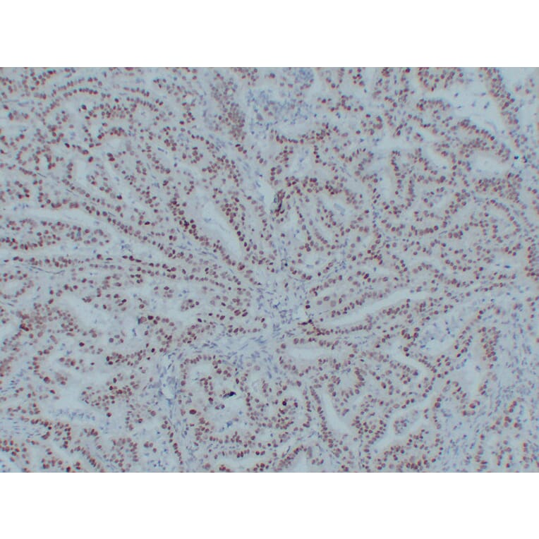 Immunohistochemistry - Anti-MutL Protein Homolog 1 Antibody (V0094) - Antibodies.com