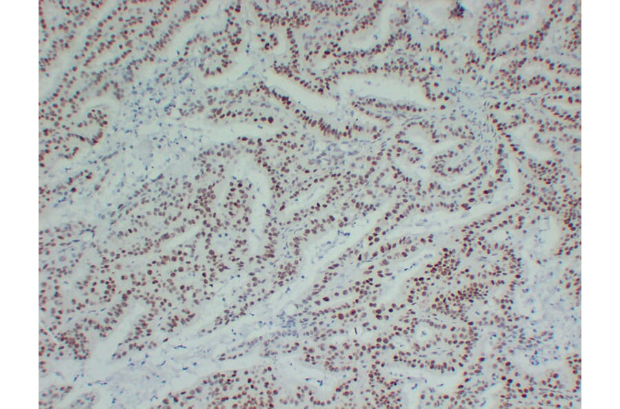 Immunohistochemistry - Anti-MutL Protein Homolog 1 Antibody (V0094) - Antibodies.com