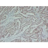 Immunohistochemistry - Anti-MutL Protein Homolog 1 Antibody (V0094) - Antibodies.com
