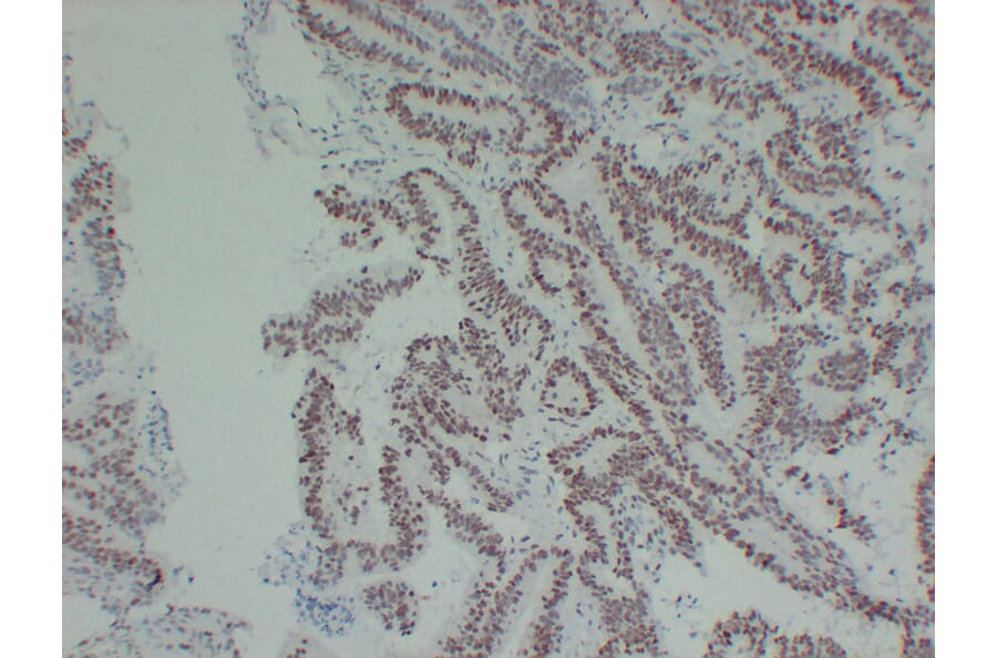 Immunohistochemistry - Anti-MutL Protein Homolog 1 Antibody (V0094) - Antibodies.com