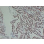 Immunohistochemistry - Anti-MutL Protein Homolog 1 Antibody (V0094) - Antibodies.com