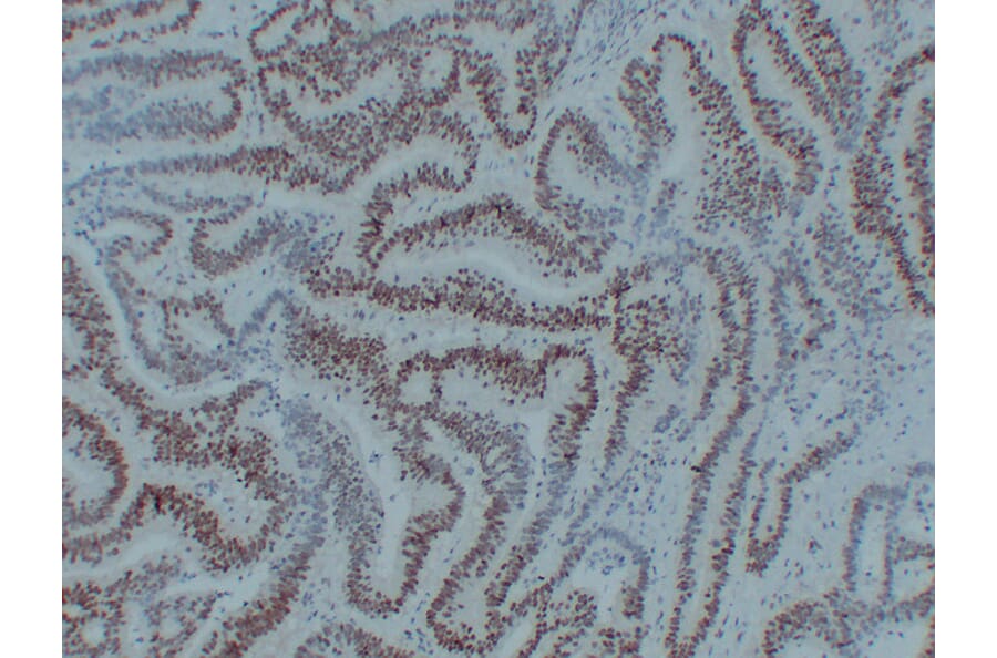 Immunohistochemistry - Anti-MutL Protein Homolog 1 Antibody (V0094) - Antibodies.com