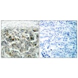 Immunohistochemistry - Anti-NF kappa B p105 / p50 Antibody (B7168) - Antibodies.com