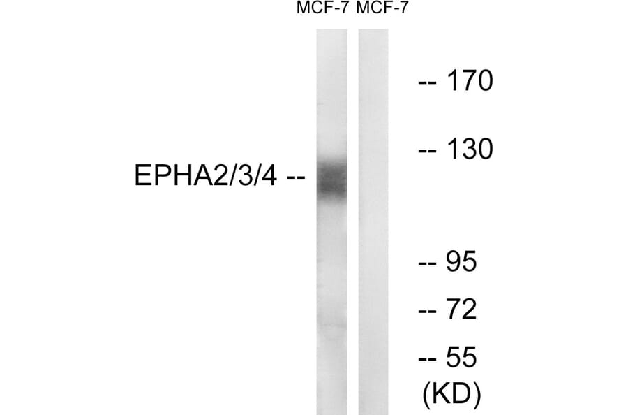 Western Blot - Anti-EPHA2 + EPHA3 + EPHA4 Antibody (B0914) - Antibodies.com