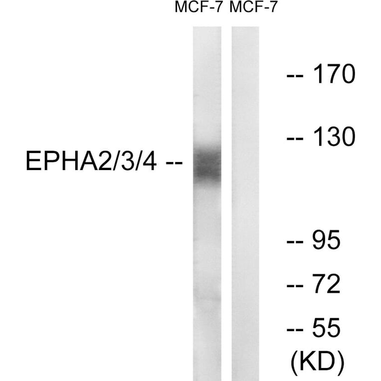 Western Blot - Anti-EPHA2 + EPHA3 + EPHA4 Antibody (B0914) - Antibodies.com