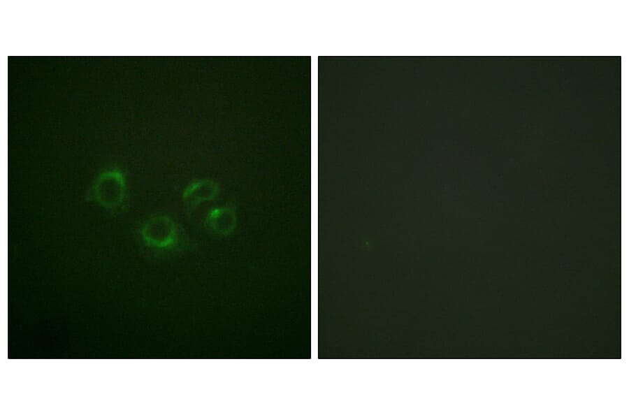 Immunofluorescence - Anti-EPHA2 + EPHA3 + EPHA4 Antibody (B0914) - Antibodies.com