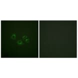 Immunofluorescence - Anti-EPHA2 + EPHA3 + EPHA4 Antibody (B0914) - Antibodies.com