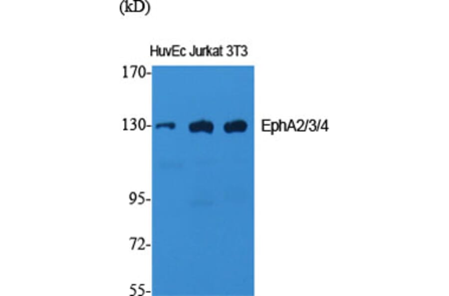 Western Blot - Anti-EPHA2 + EPHA3 + EPHA4 Antibody (B0914) - Antibodies.com