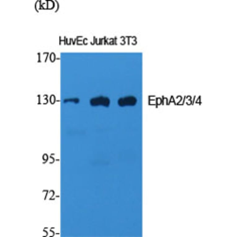 Western Blot - Anti-EPHA2 + EPHA3 + EPHA4 Antibody (B0914) - Antibodies.com