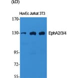 Western Blot - Anti-EPHA2 + EPHA3 + EPHA4 Antibody (B0914) - Antibodies.com