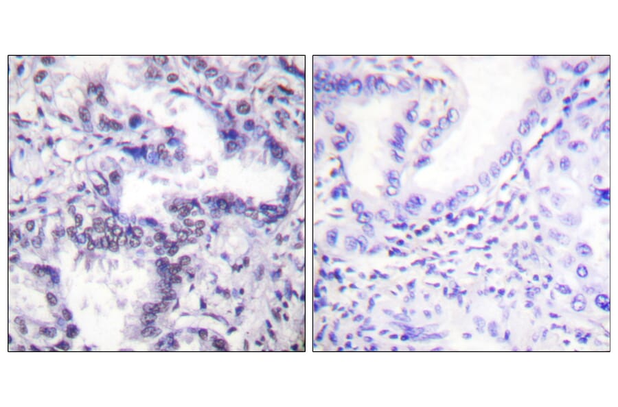 Immunohistochemistry - Anti-Ku80 (phospho Thr714) Antibody (A0450) - Antibodies.com