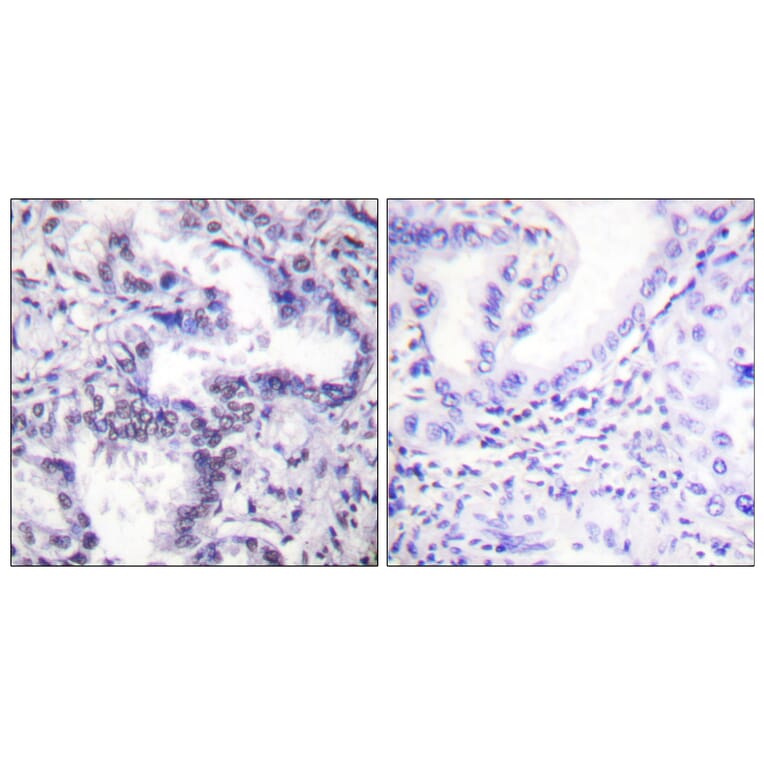 Immunohistochemistry - Anti-Ku80 (phospho Thr714) Antibody (A0450) - Antibodies.com