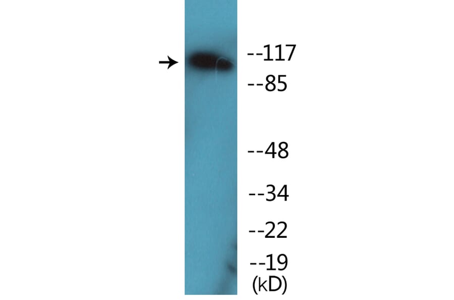 Western Blot - Anti-FLT3 (phospho Tyr599) Antibody (P12-1106) - Antibodies.com