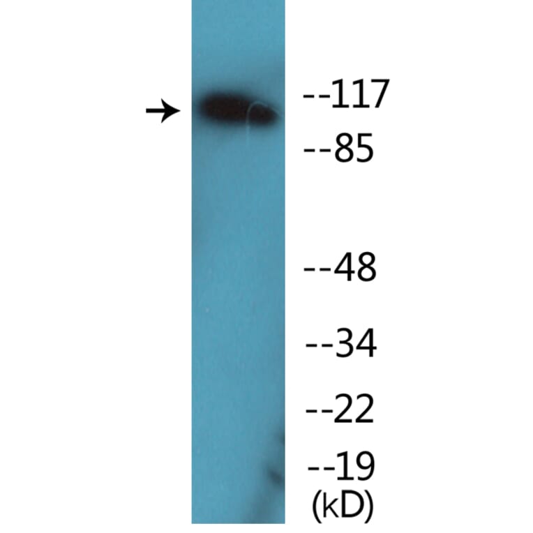 Western Blot - Anti-FLT3 (phospho Tyr599) Antibody (P12-1106) - Antibodies.com
