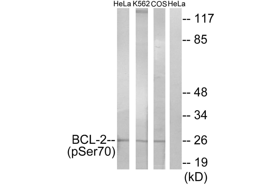 Western Blot - Anti-BCL-2 (phospho Ser70) Antibody (A7025) - Antibodies.com
