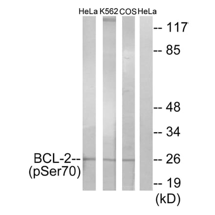 Western Blot - Anti-BCL-2 (phospho Ser70) Antibody (A7025) - Antibodies.com
