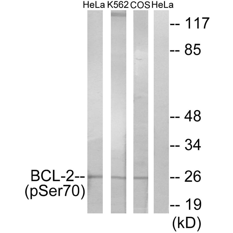 Western Blot - Anti-BCL-2 (phospho Ser70) Antibody (A7025) - Antibodies.com